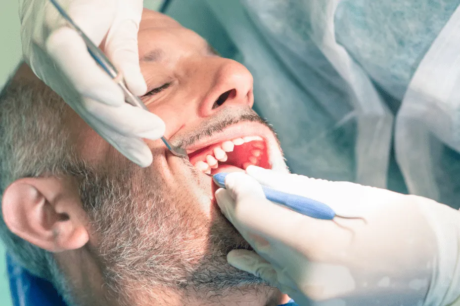 devitalizzazione del dente