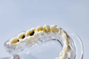 panoramica dentale carie