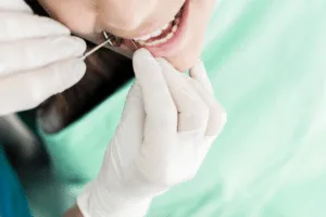 prezzo devitalizzazione denti