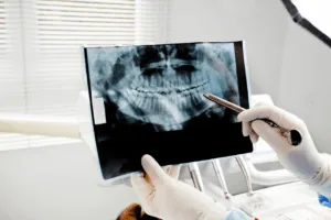 radiografie dentali