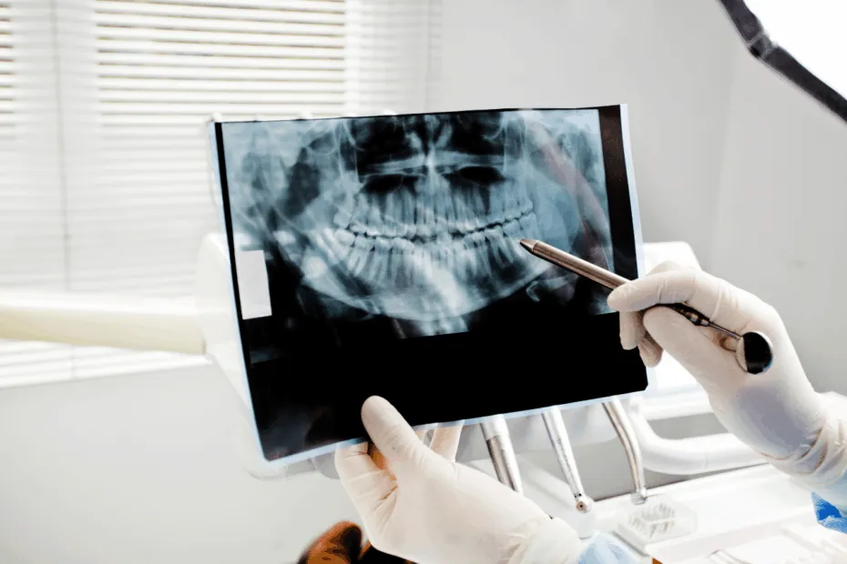 radiografie dentali